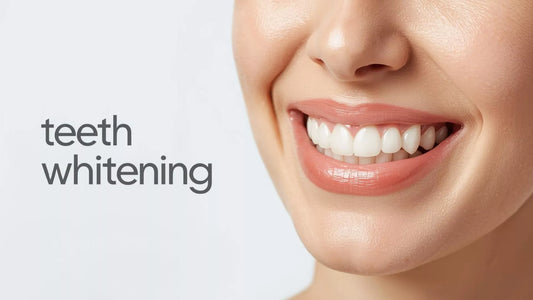 Professional vs home teeth whitening